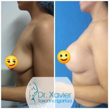 Slider image (2) Dr. Xavier Toscano - Plastic Surgeon